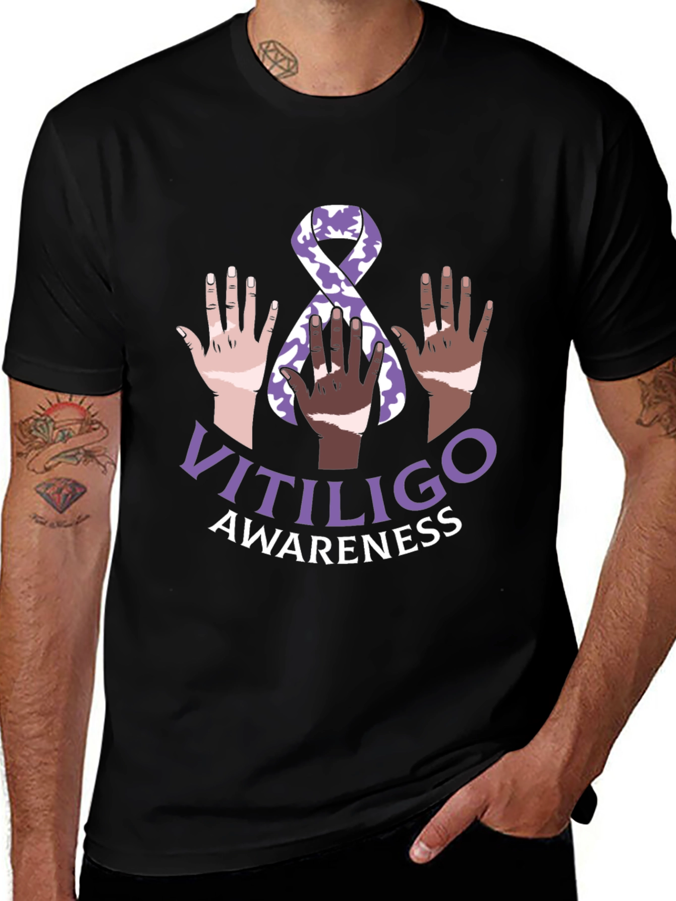 Vitiligo Awareness T-Shirt