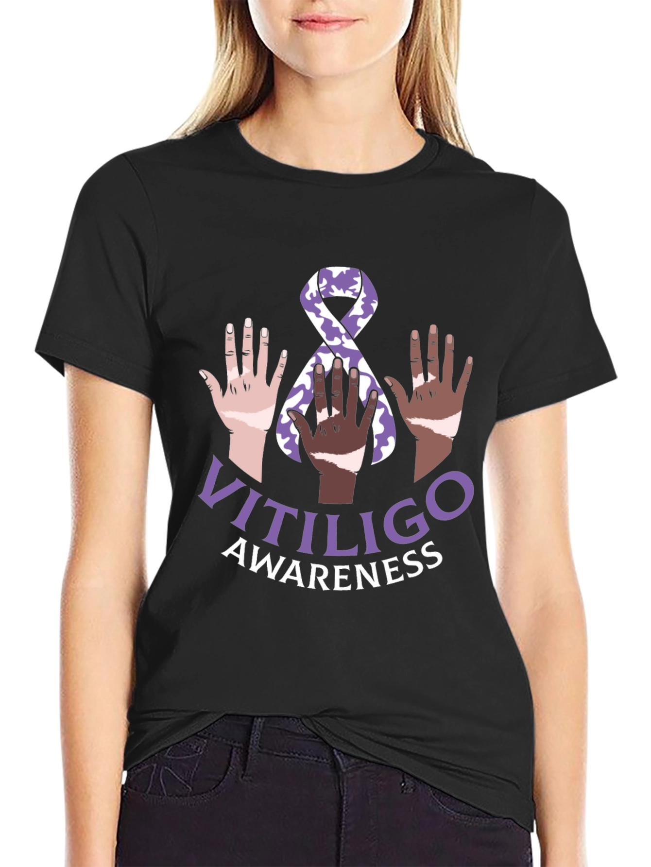 Vitiligo Awareness T-Shirt